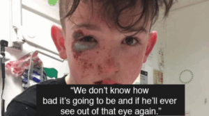 burnedchild.png