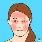 Forehead, eyes, and cheeks headache