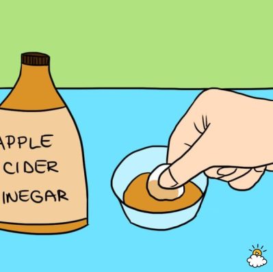 Step #2: Soak Cotton Ball in ACV
